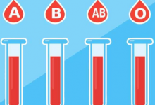 新研究表明您的血型可以预测您在60岁之前中风的风险