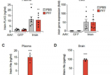 运动激素在小鼠研究中阻止帕金森病症状
